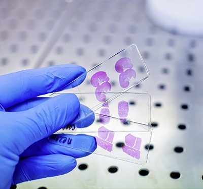 Histopathology / Cytology Cells
